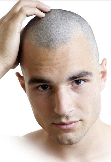 Bald head hair for men.PNG
